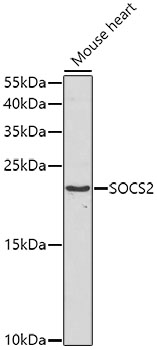 Anti-SOCS2 Antibody (CAB5703)