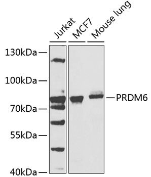 Anti-PRDM6 Antibody (CAB7846)