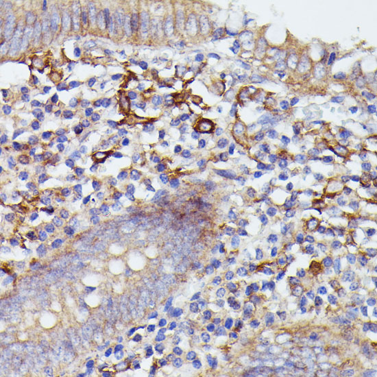 Anti-SNAP23 Antibody (CAB13909)