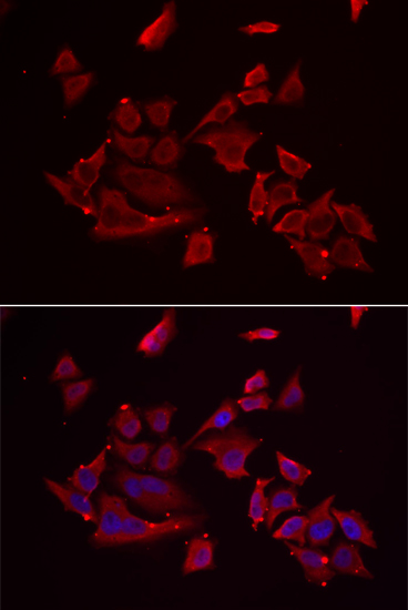 Anti-RARRES2 Antibody (CAB6963)