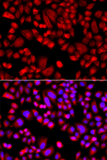 Anti-ARPC3 Antibody (CAB7767)