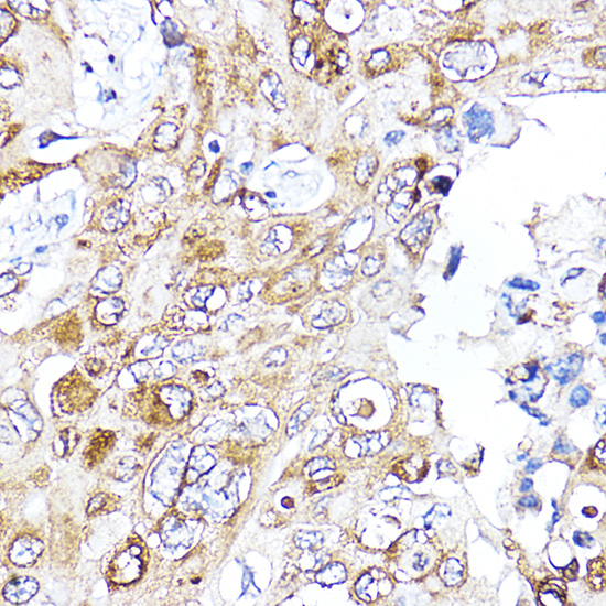 Anti-VEGF Antibody (CAB12303)