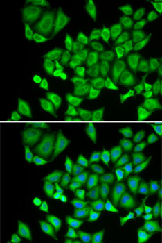 Anti-DHRS9 Antibody (CAB6324)