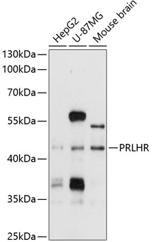 Anti-PRLHR Antibody (CAB10479)