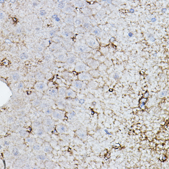 Anti-CHAT Antibody (CAB2495)