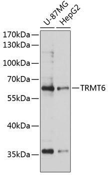 Anti-TRMT6 Polyclonal Antibody (CAB9212)