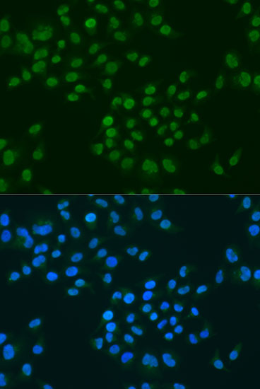 Anti-CIRBP Antibody (CAB6080)