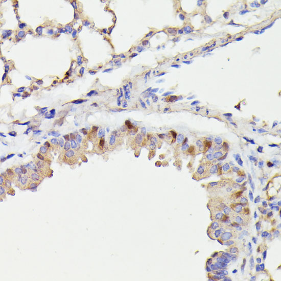 Anti-CDC23 Antibody (CAB15116)