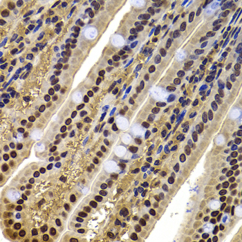 Anti-ACTL6B Antibody (CAB7108)