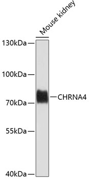 Anti-CHRNA4 Antibody (CAB1648)