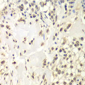 Anti-HAUSP / USP7 Antibody (CAB13564)