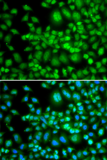 Anti-SETD5 Antibody (CAB14140)