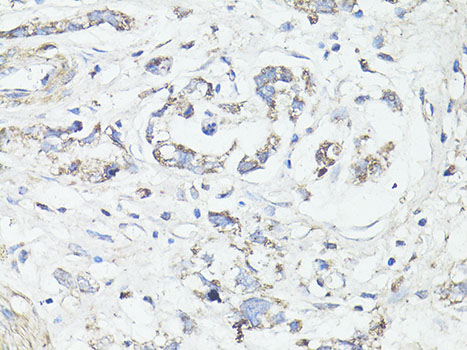 Anti-LC3A / LC3B Antibody (CAB15591)