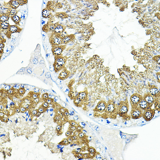 Anti-CALM1 Antibody (CAB14711)