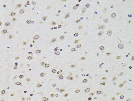 Anti-TMPO Antibody [KO Validated] (CAB2534)