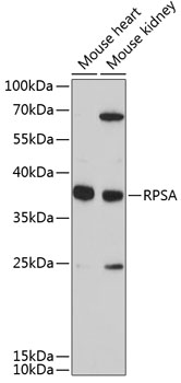 Anti-RPSA Polyclonal Antibody (CAB9008)