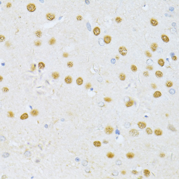 Anti-SATB1 Antibody (CAB5800)