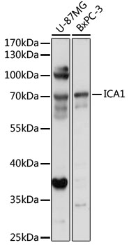 Anti-ICA1 Antibody (CAB17500)