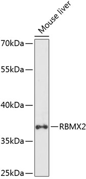 Anti-RBMX2 Antibody (CAB14321)