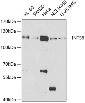 Anti-INTS6 Antibody (CAB6634)