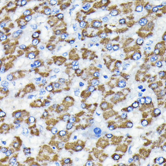 Anti-Smad3 Antibody [KO Validated] (CAB19115)