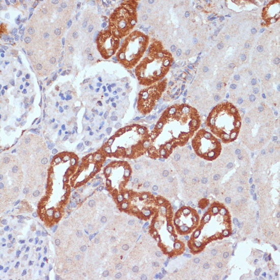 Anti-PDGFR beta Antibody (CAB2180)