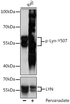 Anti-Phospho-Lyn-Y507 pAb (CABP0855)