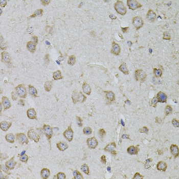 Anti-TRPC3 Antibody (CAB7742)