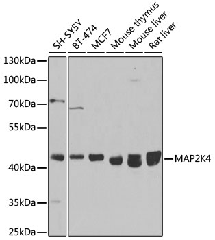 Anti-MAP2K4 Antibody [KO Validated] (CAB14781)