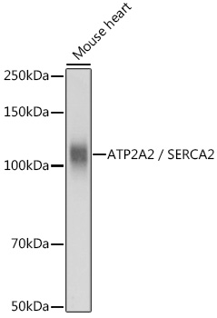 Anti-ATP2A2 / SERCA2 Antibody (CAB0098)