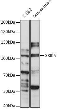 Anti-GRIK5 Antibody (CAB15676)