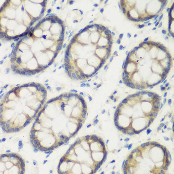 Anti-TGM5 Antibody (CAB7039)