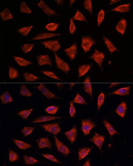 Anti-STAM2 Antibody (CAB7058)