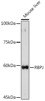 Anti-RBPJ Antibody (CAB5675)