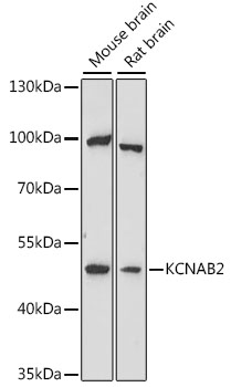 Anti-KCNAB2 Antibody (CAB16224)