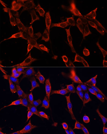 Anti-FBN1 Antibody (CAB16677)