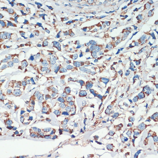 Anti-APC Antibody (CAB2818)