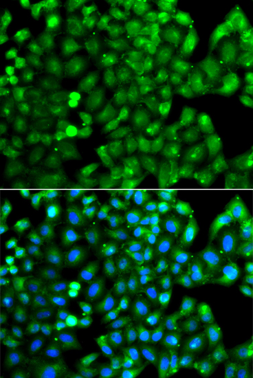 Anti-HLA-DRB1 Antibody (CAB7685)