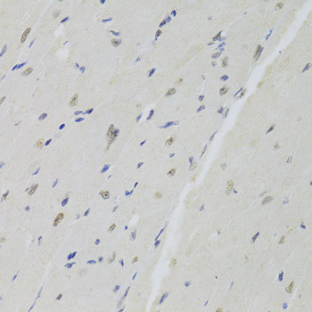 Anti-DOK1 Antibody (CAB5687)