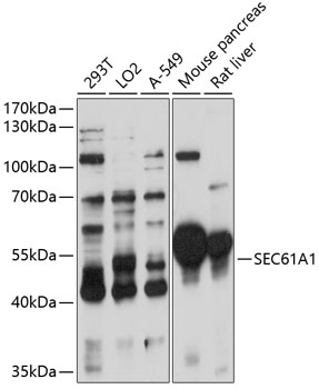 Anti-SEC61A1 Antibody (CAB11658)
