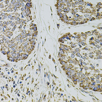 Anti-SELP Antibody (CAB1425)