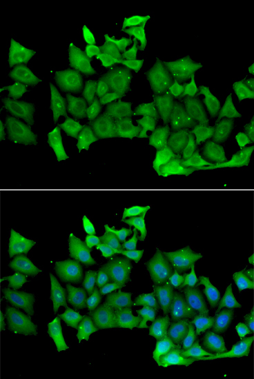 Anti-RHOH Antibody (CAB6356)