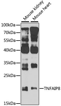 Anti-TNFAIP8 Polyclonal Antibody (CAB8064)