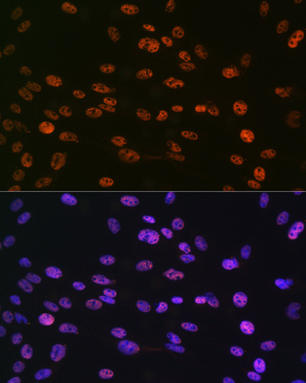 Anti-Phospho-Histone H3-S10 pAb (CABP0840)