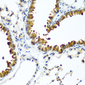 Anti-TAZ Polyclonal Antibody (CAB8202)