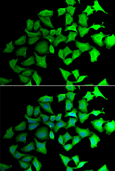 Anti-TALDO1 Antibody (CAB6762)