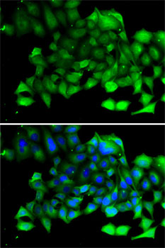 Anti-CLIC4 Antibody (CAB7088)