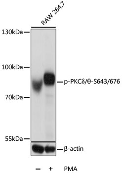 Anti-Phospho-PKCdelta/theta-S643/676 Antibody (CABP0567)