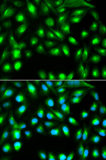 Anti-GEMIN2 Antibody (CAB3082)