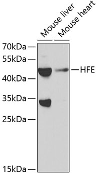 Anti-HFE Antibody (CAB1310)